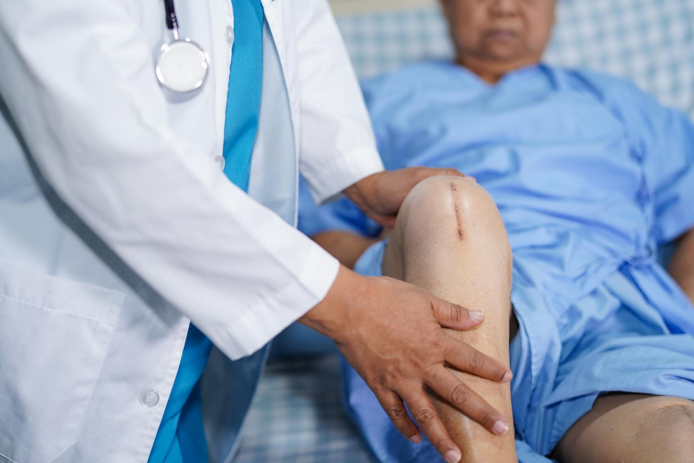 GAE knee procedure